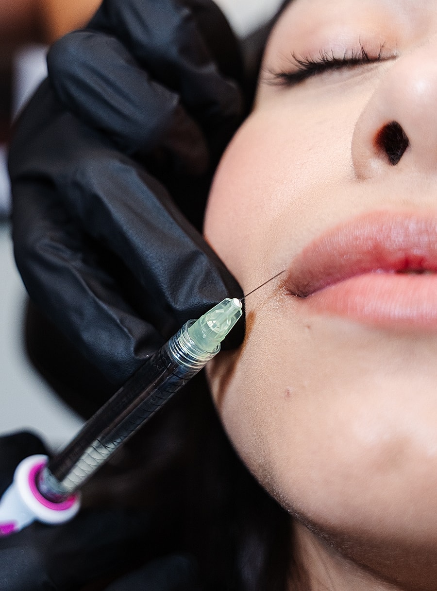 Cosmetic procedure on a woman's lips.